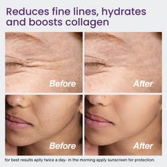 Base 9™ Face Serum-6 Peptides Anti Ageing Formula