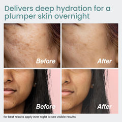 Arbutique™ Alpha Arbutin Night Cream