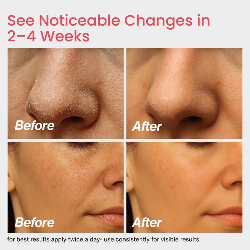 Cica Aura™ Centella Face Moisturizer with Intensive Hydration